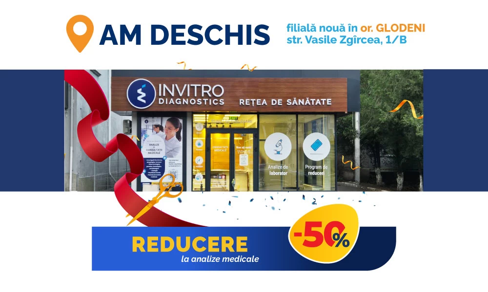 -50 % reducere la analize, pentru locuitorii din or. Glodeni.