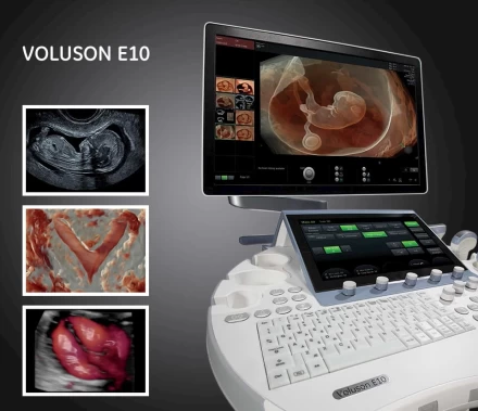 Ultrasonografie de performanţă exclusivă 4D la Invitro Diagnostics