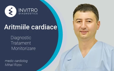 Aritmiile cardiace – diagnostic, evaluare, tratament și monitorizare continuă la Invitro Diagnostics