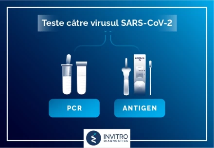 Testarea pentru virusul SARS-CoV-2