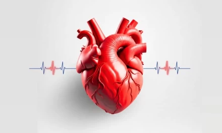 Cardiovascular Check-up - Basic / 30% off