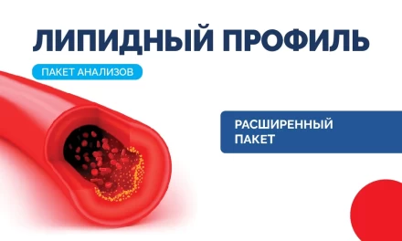 Липидный профиль, расширенный