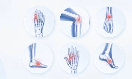 Extended Rheumatic Tests